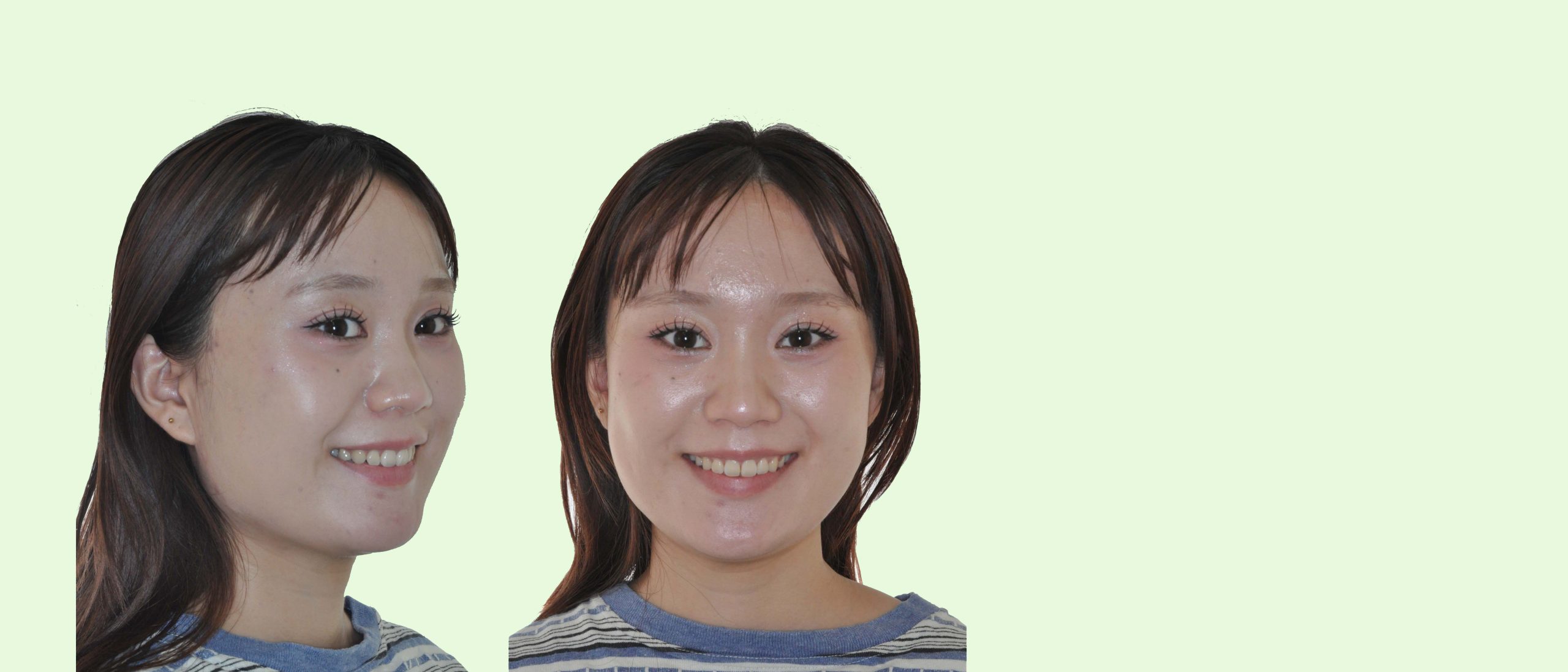 おおいで矯正歯科 の写真