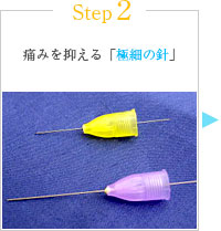 Step2 痛みを抑える「極細の針」